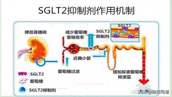 能把葡萄糖尿出去且還有保護心腎作用的降糖藥是哪種?藥師告訴你 能把葡萄糖尿出去且還有保護心腎作用的降糖藥是哪種?藥師告訴你