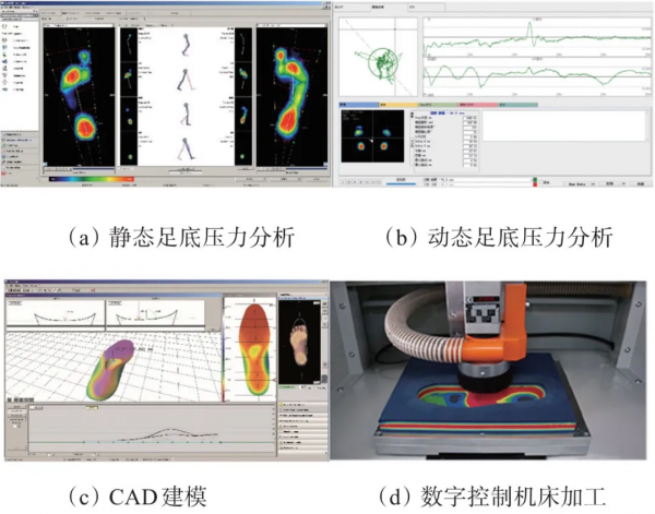 3D列印矯形鞋墊助力膝關節骨性關節炎早期治療 3D列印矯形鞋墊助力膝關節骨性關節炎早期治療