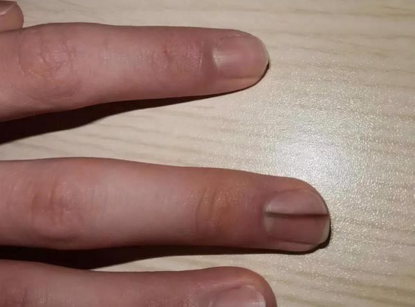 一斗窮，二斗富是真的嗎？“鬥”越多的人越長壽？中科院揭開真相