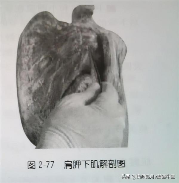 肩部疼痛的觸診圖解（很珍貴資料），值得一看