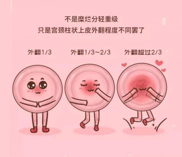 日本女性壽命長，婦科病少，3個&OpenCurlyDoubleQuote;做法&rdquo;貢獻大，值得我們學習