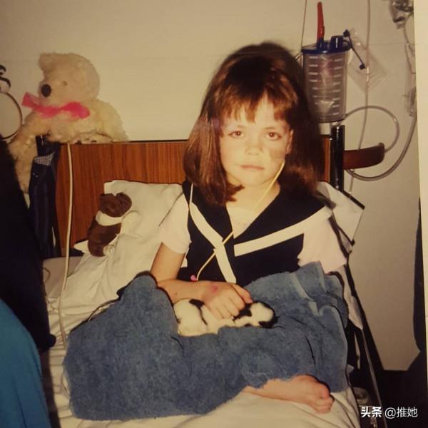 6歲被截肢，20歲被網暴，女孩兒鼓足勇氣成為內衣模特