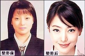 整容後遺症好可怕,這些初代韓國明星,靠高顏值爆紅,如今認不出 整容後遺症好可怕,這些初代韓國明星,靠高顏值爆紅,如今認不出