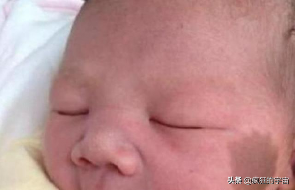為啥很多剛出生的嬰兒屁股上都有“淤青“?答案終於來了 為啥很多剛出生的嬰兒屁股上都有“淤青“?答案終於來了