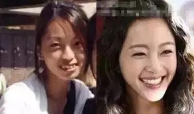 宋智雅當選韓國top長相,但其實是下等臉? 宋智雅當選韓國top長相,但其實是下等臉?