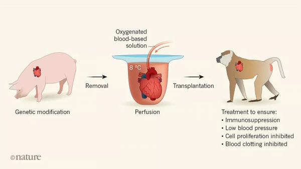 全球首例！美國57歲男子成功移植轉基因「豬心」，異種移植創奇蹟