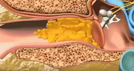 小米有品的掏耳勺火了,500W畫素看得清清楚楚,掏得明明白白 小米有品的掏耳勺火了,500W畫素看得清清楚楚,掏得明明白白