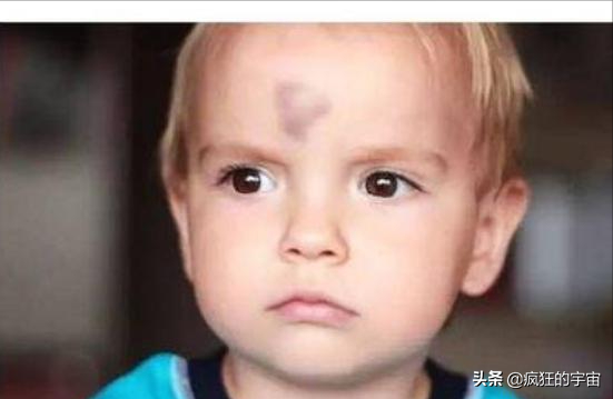 為啥很多剛出生的嬰兒屁股上都有“淤青“?答案終於來了 為啥很多剛出生的嬰兒屁股上都有“淤青“?答案終於來了