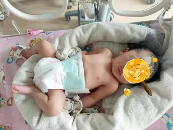 二胎媽媽突發胎盤早剝,多學科展開生死營救 二胎媽媽突發胎盤早剝,多學科展開生死營救