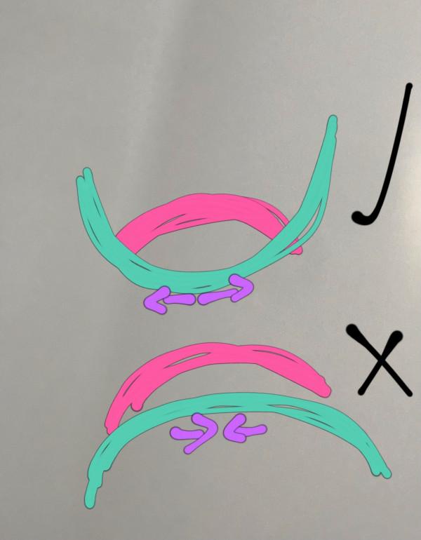 她練瑜伽2年，後彎一直很輕鬆很深入，最近卻發現骨盆越來越大