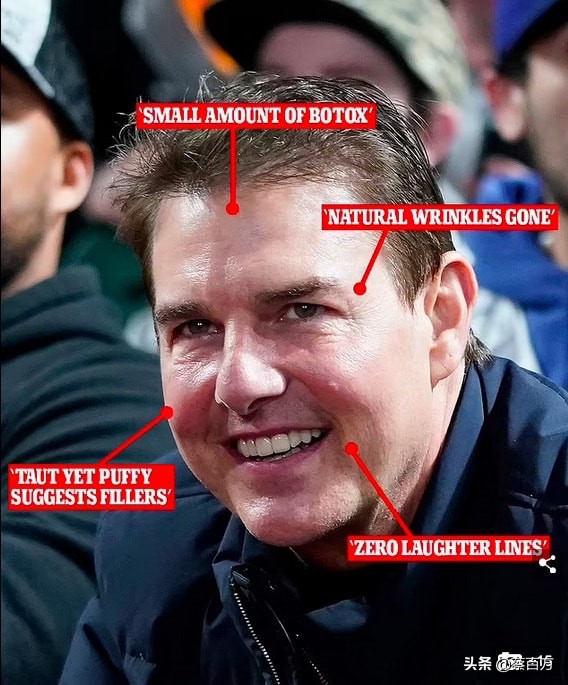 貝嫂番茄炒蛋紅黃配色著裝被嘲像麥當勞叔叔，網友：不要再打針了