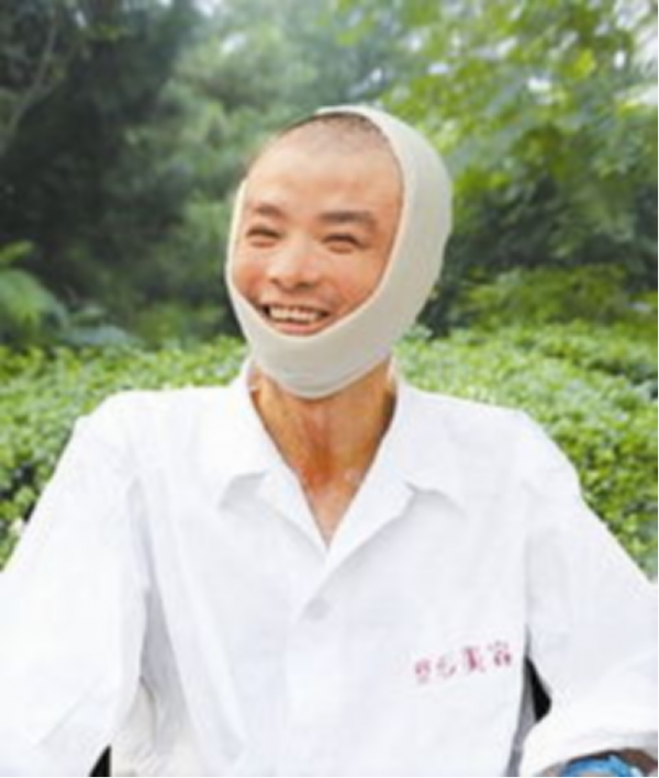 11年前,那個探親中途浴火救44人,全身90%燒傷的子弟兵,現況如何