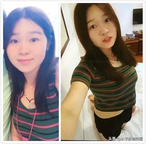 80斤女孩減肥長期不吃主食住進ICU，瘦真的是美的唯一標準嗎？