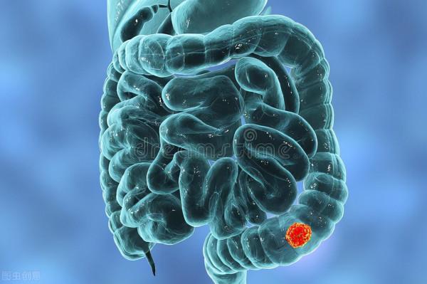 年輕小夥患直腸癌，才一年多就枯瘦如柴？離世前的忠告，引人深思