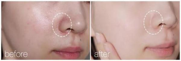 建議大家：逛超市的時候，遇到這3個老牌“萬能霜”，別錯過