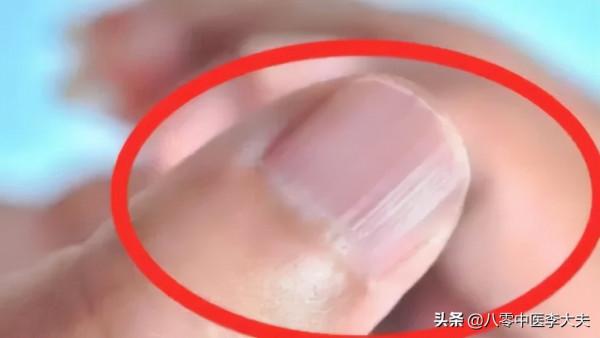 色斑,老年斑,嘴唇黑,胸口刺痛疼?血府逐瘀,活血化瘀,氣血旺 色斑,老年斑,嘴唇黑,胸口刺痛疼?血府逐瘀,活血化瘀,氣血旺