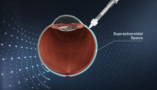 極目生物CEO胡海迪博士:「創新科技+輕鬆醫療」,打造眼科領域新商業模型丨36氪專訪 極目生物CEO胡海迪博士:「創新科技+輕鬆醫療」,打造眼科領域新商業模型丨36氪專訪