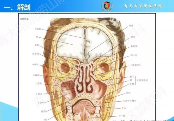 頭頸五官CT斷層解剖圖及常見病影像診斷