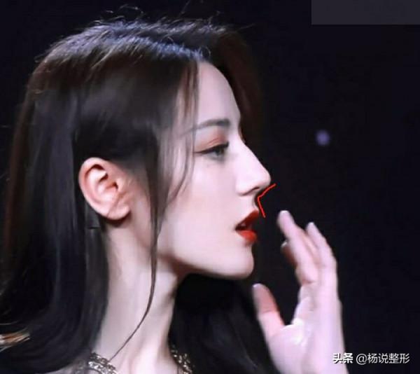 隆鼻幾年後臉會垮掉？你最擔心的隆鼻問題正在解答