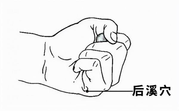 落枕辨經針灸療法