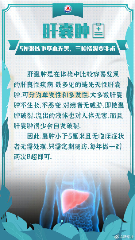 體檢報告上的結節息肉都是啥? 體檢報告上的結節息肉都是啥?