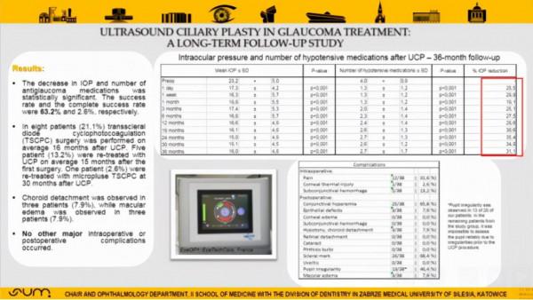 超聲睫狀體成形術治療難治性青光眼療效如何？