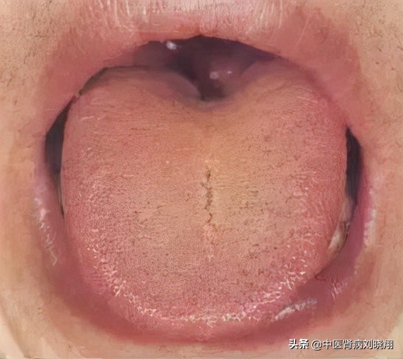 劉主任讓病人伸舌頭，看的是什麼？