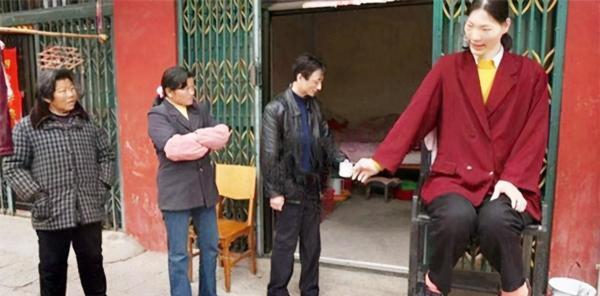 &quot;世界第一女巨人&quot;：穿78碼鞋子，一頓吃2斤米飯，曾夢想吃頓飽飯