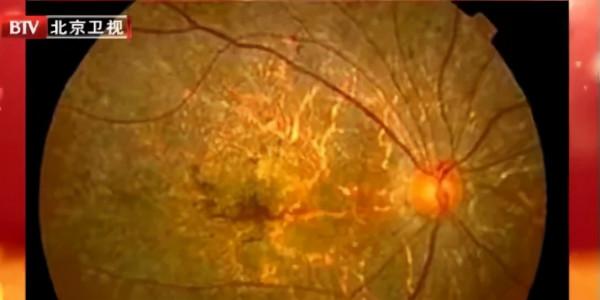 藏在果蔬裡的“天然營養素”,抗氧化,護血管,除口臭 藏在果蔬裡的“天然營養素”,抗氧化,護血管,除口臭