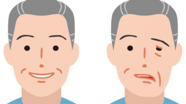面肌痙攣該如何預防，患有面肌痙攣又該如何調理