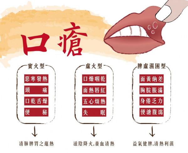 長期口腔潰瘍怎麼辦？除了清熱還需養陰，中醫辨證，幫你一招斷根
