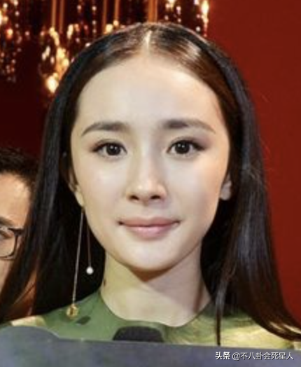 那些亂整鼻子的女明星還好嗎？後遺症一大堆，楊冪金晨都開始崩了