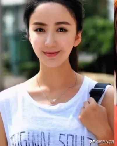 娛樂圈明星整容前後大對比，打消你整容的心