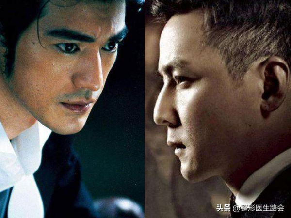 從事醫美整形工作30+年，談談我眼中的男女審美差異？