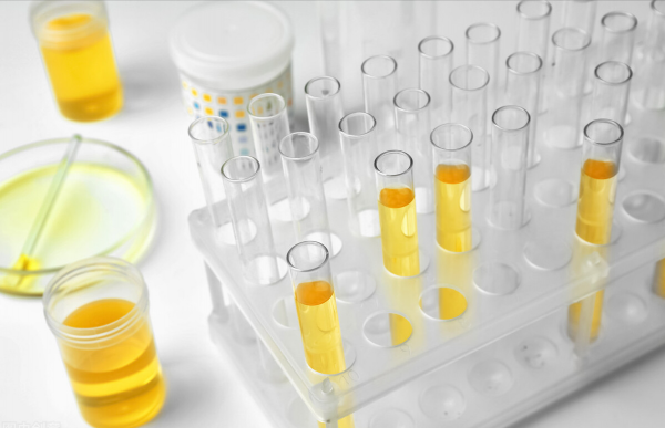 渴絡欣，降血糖血脂，降肌酐尿蛋白，保護腎小球，改善糖尿病腎病