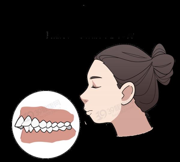 為什麼只要戴牙套,牙齒就可以恢復得很整齊?生動展示矯正過程 為什麼只要戴牙套,牙齒就可以恢復得很整齊?生動展示矯正過程