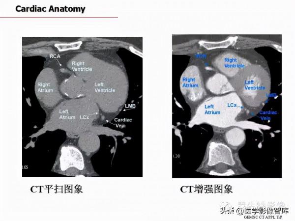 CT斷層解剖圖譜最全總結「推薦收藏」 CT斷層解剖圖譜最全總結「推薦收藏」