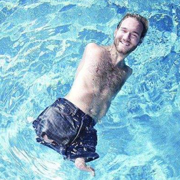 1982年，那個天生沒有四肢的澳大利亞男子尼克&CenterDot;胡哲，後來怎樣了