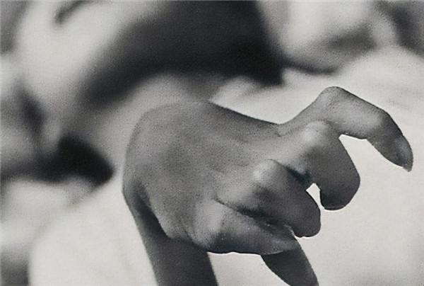 1996年，兩滴液體滴在她的手套上，送醫院搶救3周後不治身亡