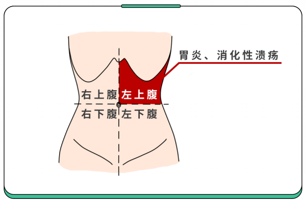 孩子頻繁肚子疼，究竟咋了？1根手指幫你判斷！（大人也適用）