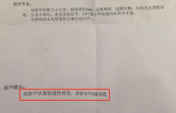 甲狀腺功能報告單，看哪幾項指標確定橋本甲狀腺炎？大夫教你