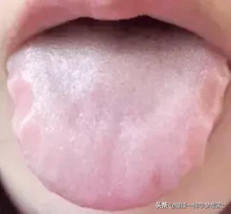 早起照鏡子,你的舌頭邊上有沒有齒痕,齒痕舌代表什麼意思 早起照鏡子,你的舌頭邊上有沒有齒痕,齒痕舌代表什麼意思