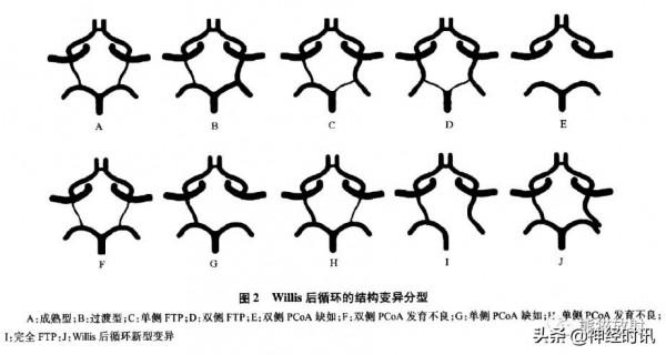 Willis環丨超細解剖+超全變異
