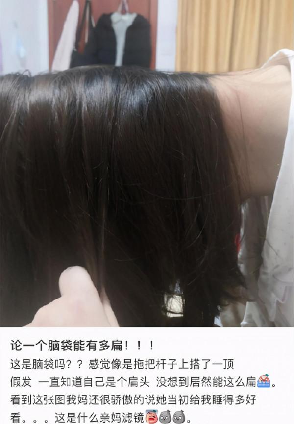 “扁頭”最扁能有多誇張？女孩曬照自嘲，圓頭才是孩子的福氣