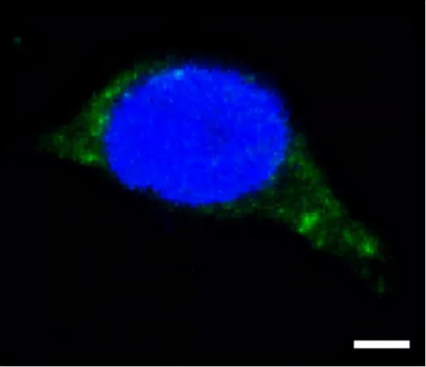 「技術分享」熒光原位雜交技術全攻略 「技術分享」熒光原位雜交技術全攻略