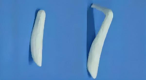 韋敏科普丨為什麼假體隆鼻,高度不能隨心所欲? 韋敏科普丨為什麼假體隆鼻,高度不能隨心所欲?