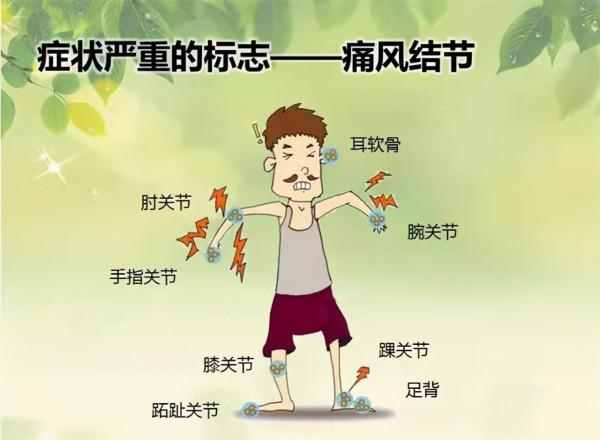 尿酸高,如何讓尿酸排出體外?醫生總結:3個辦法,實用有效 尿酸高,如何讓尿酸排出體外?醫生總結:3個辦法,實用有效