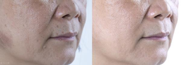 你知道“苦瓜臉”是怎麼形成的嗎？