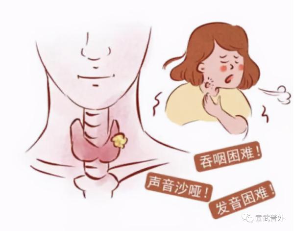 甲狀腺癌的“自白”