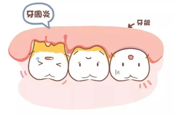 懷孕了，牙疼怎麼辦？